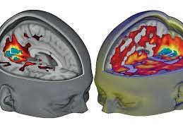 how does ibogaine work for addiction